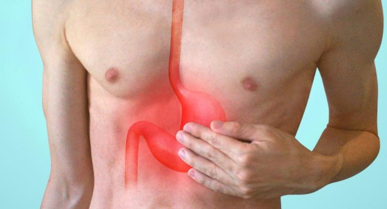 Metode naturale pentru ameliorarea refluxului gastric Cum sa eviti simptomele