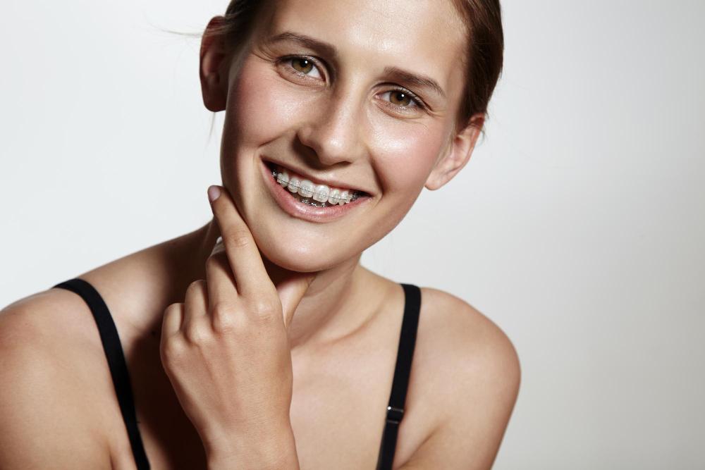Aparat dentar conventional vs gutiere transparente Ce ti se potriveste