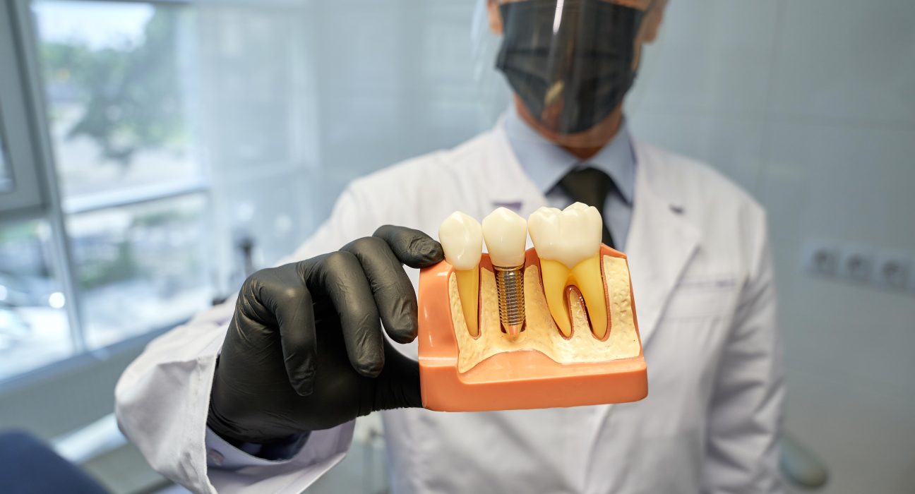 Etapele implantului dentar Procedura pas cu pas